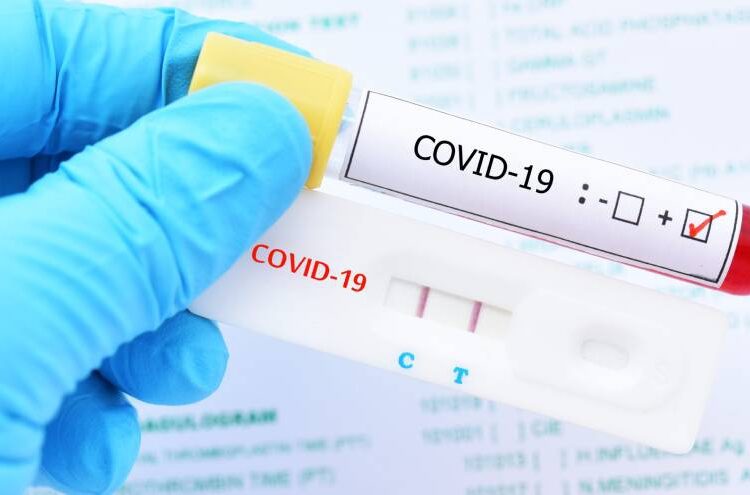 La aparición de nuevos positivos de Corona Virus preocupa a las autoridades sanitarias
