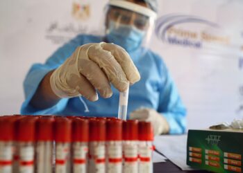 Covid-19: un estudio argentino demuestra que 95% de pacientes desarrolló anticuerpos a los 45 días
